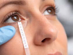 Dry Eye Test Practice Work Sheet - Specimen